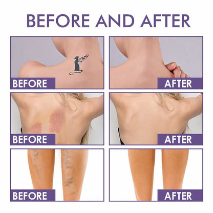 Body Perfector - Evens skin tone and corrects skin imperfections