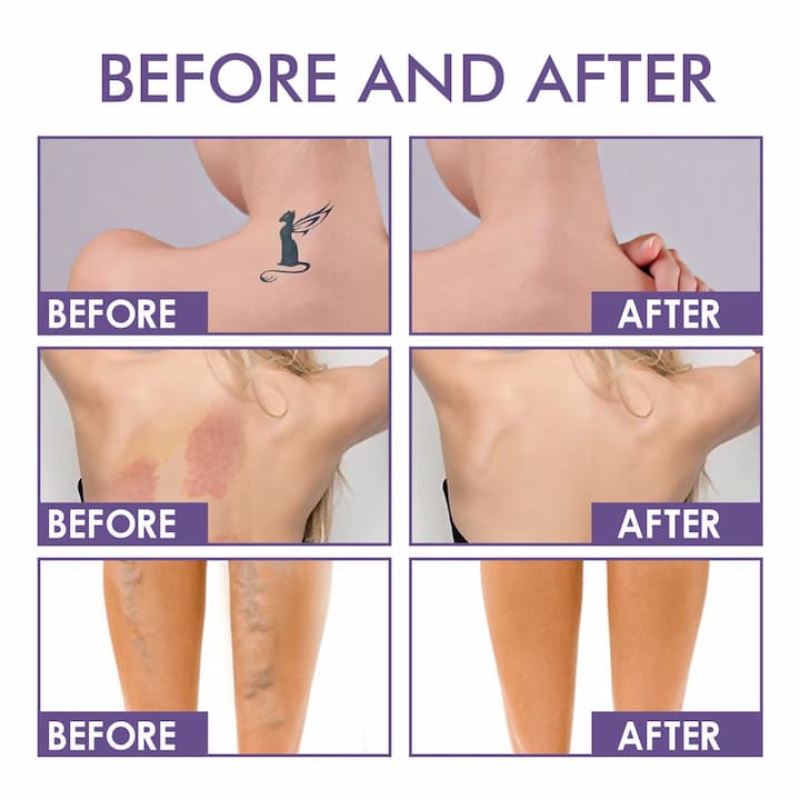 Body Perfector - Evens skin tone and corrects skin imperfections