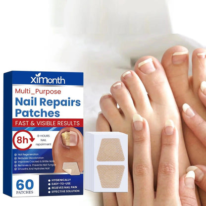Nail Patches - Patches for Treating Nail Fungus [60 pieces]