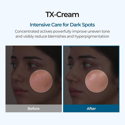 Cream for the removal of dark spots