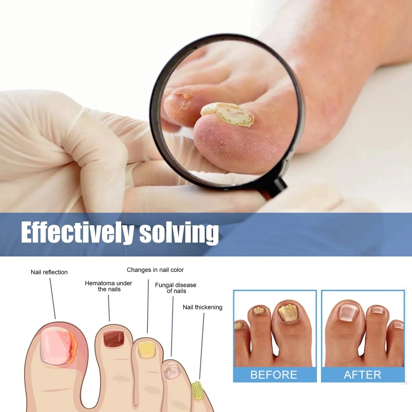 Nail Patches - Patches for Treating Nail Fungus [60 pieces]