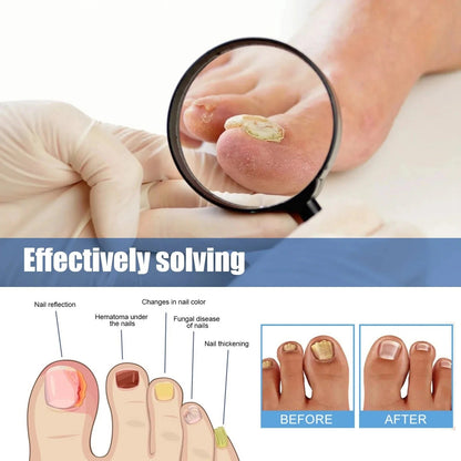 Nail Patches - Patches for Treating Nail Fungus [60 pieces]