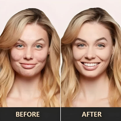 TintMatch - Color Changing Foundation for Flawless, Perfectly Toned Skin