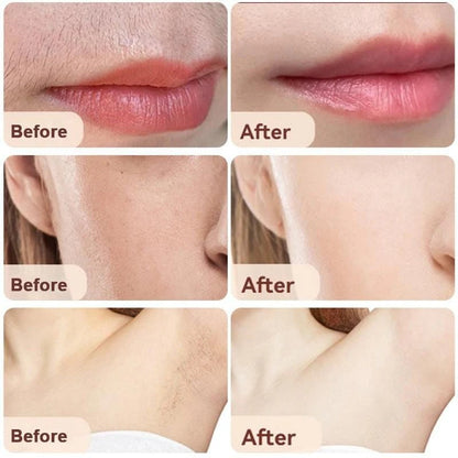 ShineTrim - 2-in-1 Facial Hair Remover