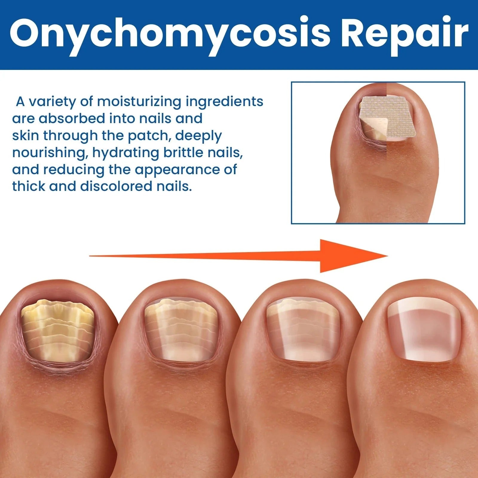 Nail Patches - Patches for Treating Nail Fungus [60 pieces]