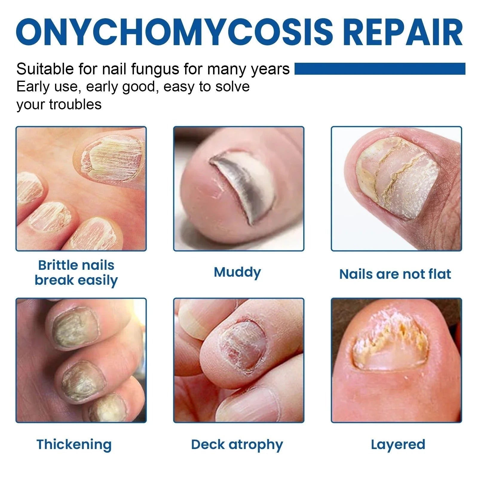 Nail Patches - Patches for Treating Nail Fungus [60 pieces]