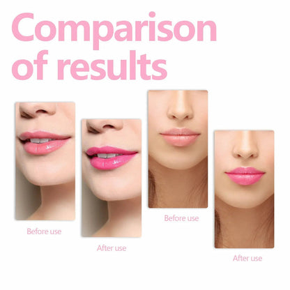 Loli Lips - Unleash your unique shine with soft, luscious lips that invite to be kissed